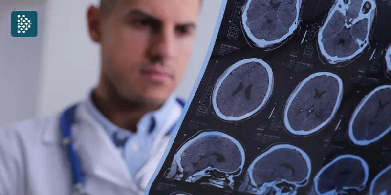 médico analisando resultado de uma tomografia no cérebro com uso do Datasigh - Inteligencia Artificial