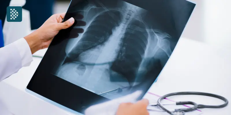 médico analisando o raio-x de um pulmão com a ajuda de uma IA generativa