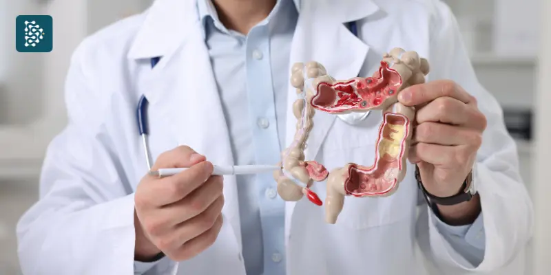 maquete médica de um intestino usada para atendimento hospitalar