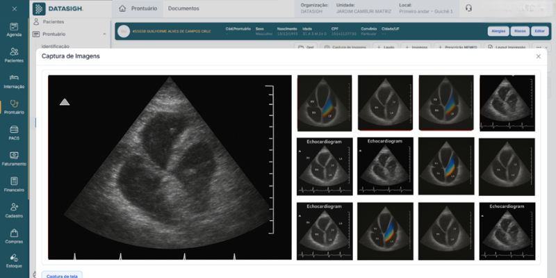 Tela de captura de imagem de radiologia feita com o sistema datasigh