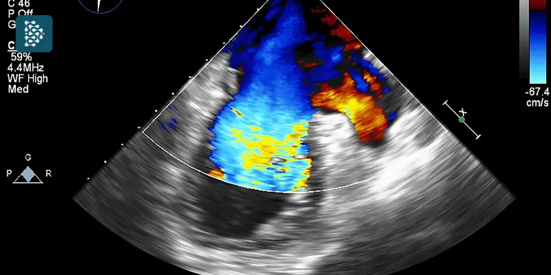 Tela de ecocardiograma exibida em computador durante exame médico realizado por cardiologista em clínica de cardiologia.